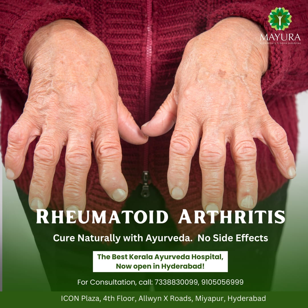 Rheumatoid Arthritis