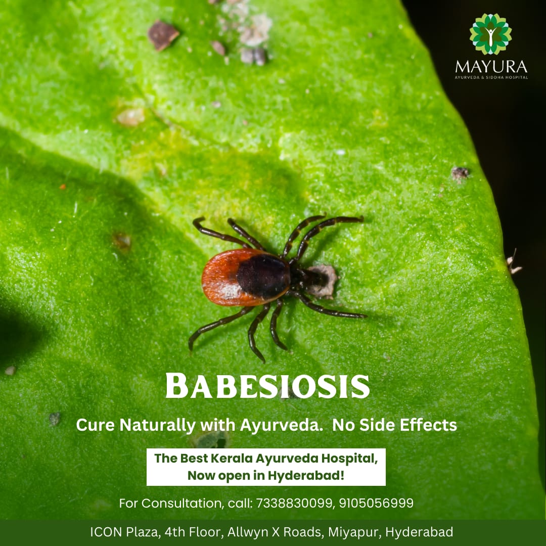 Babesiosis Management