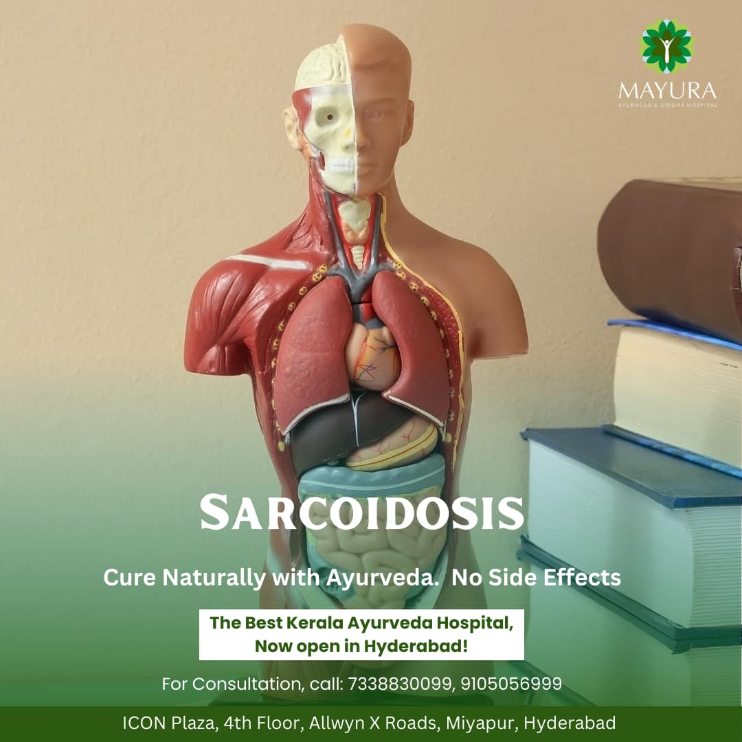 Navigating Sarcoidosis