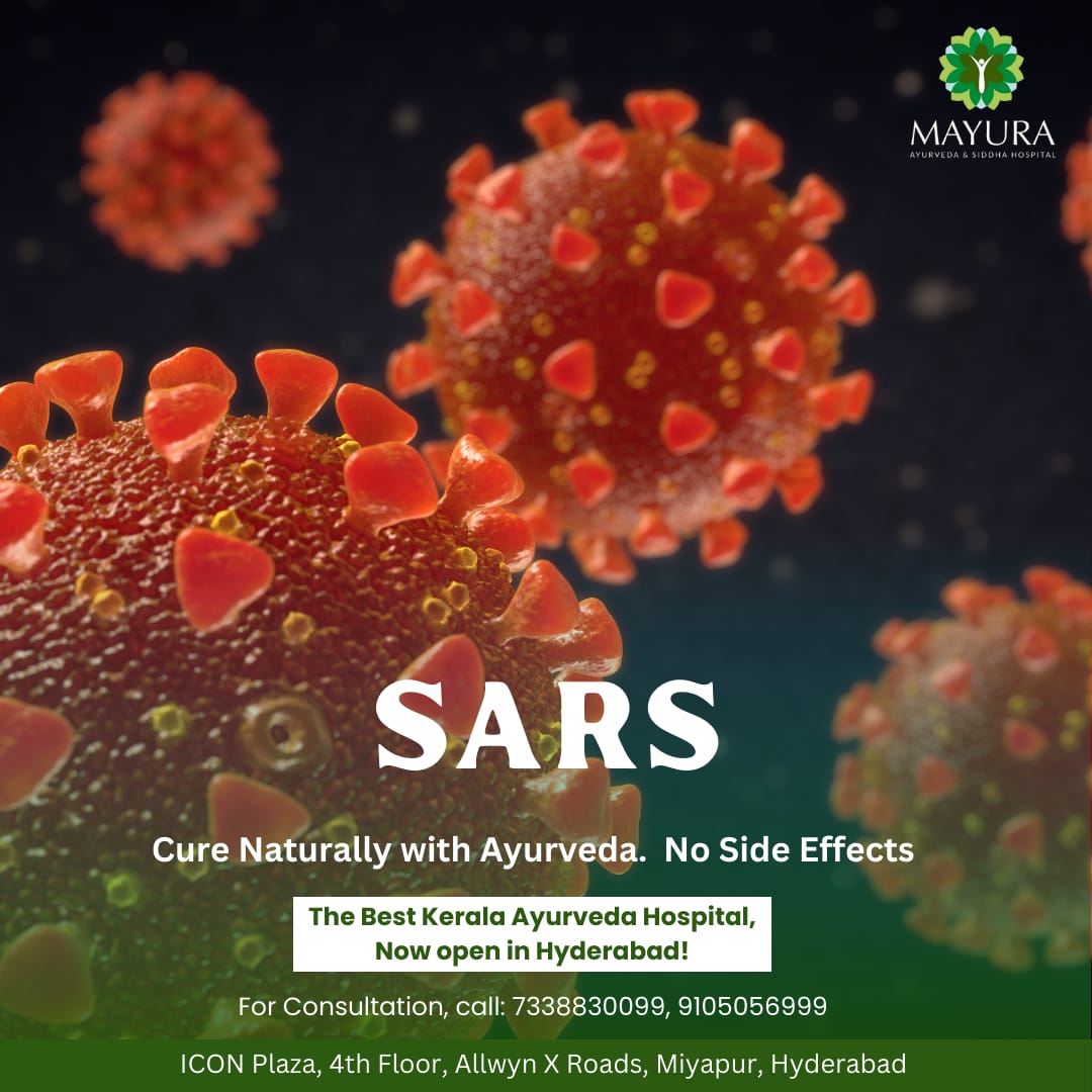 SARS