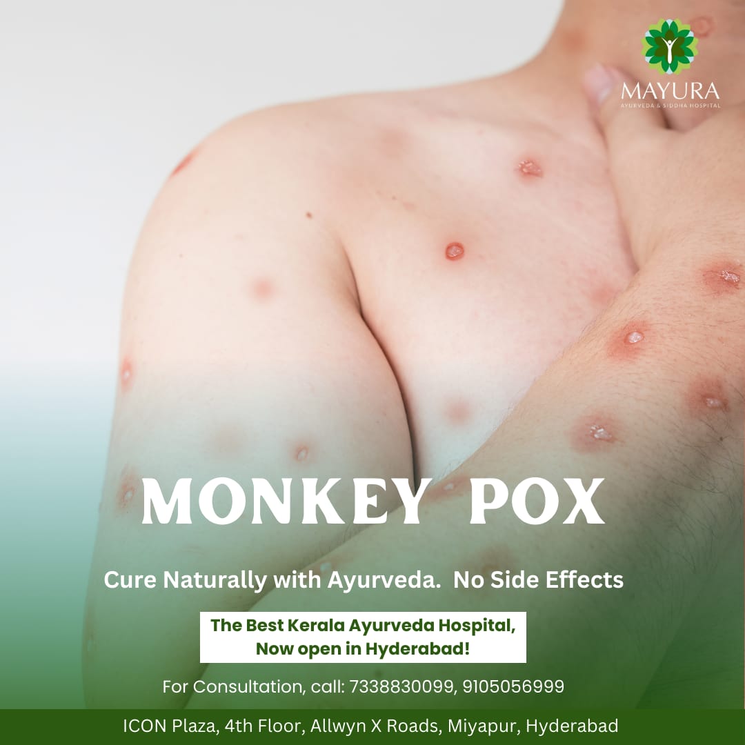 monkeypox