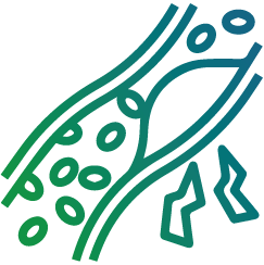 Hyperlipidemia treatment