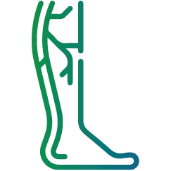 Varicose Veins